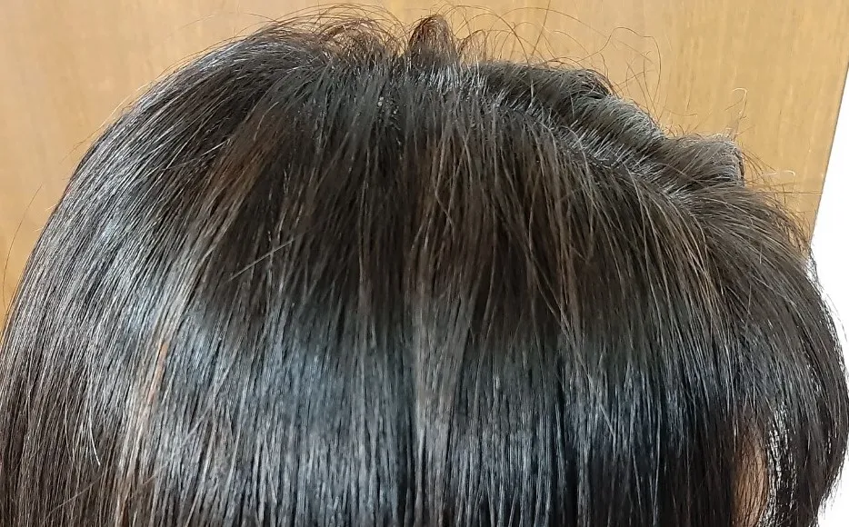 ทำไมผมหงอกถึงสีเพี้ยน 2 สาเหตุหลักที่ทำให้ผมเสียสวย